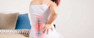 Woman With Sciatica and Lower Back Pain.